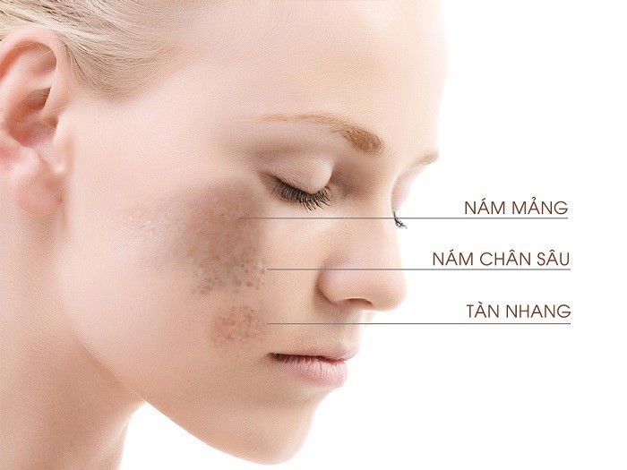 nam mang nam chan san tan nhang