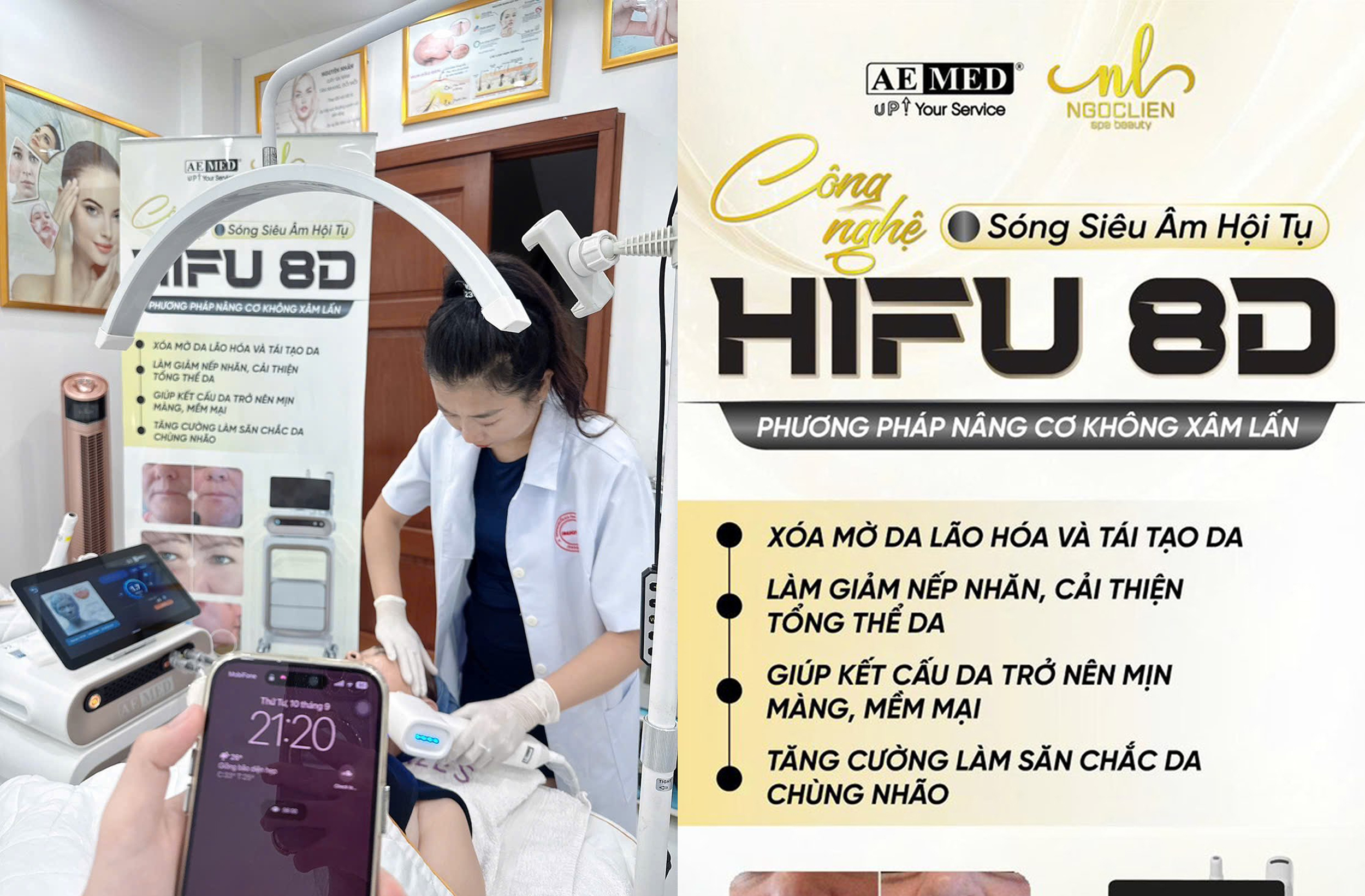 Công nghệ Hifu 8D