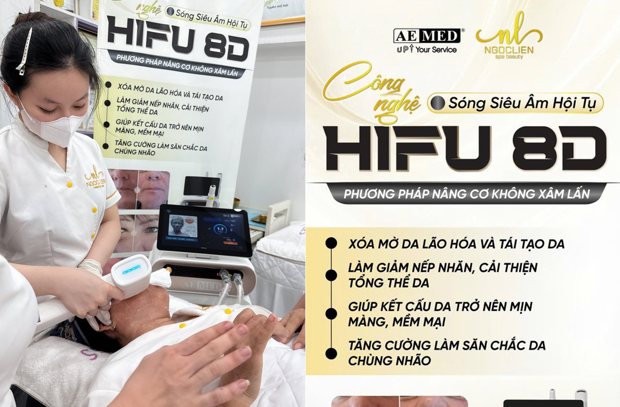 Công nghệ Hifu 8D tại Bình Chánh